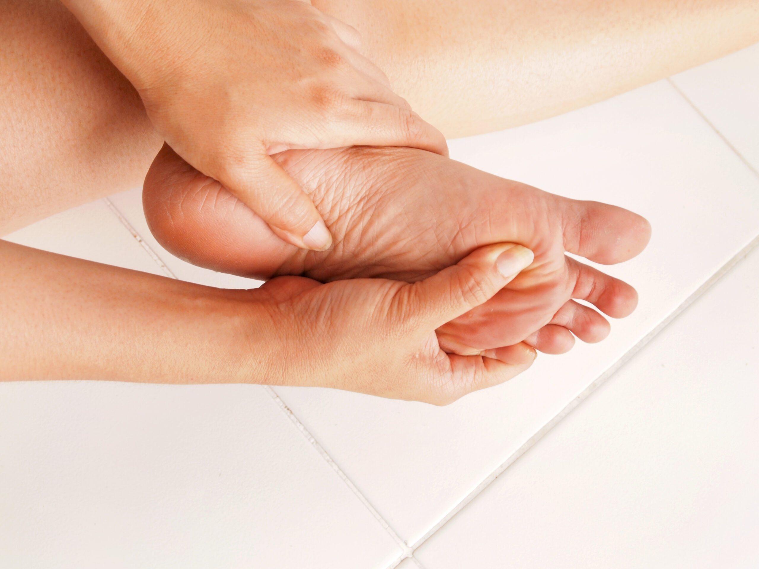 Fascitis plantar Fascitis plantar fisioterapia en madrid